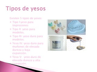 Existen 5 tipos de yesos: Tipo I:yeso para impresiones Tipo II: yeso para modelos. Tipo III: yeso duro para modelos. Yeso IV: yeso duro para muñones de elevada dureza y baja expansión. Yeso V:  yeso duro de elevada dureza y alta expansión. 