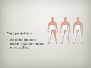 • Yeso pelvipédico-

  • Se aplica desde el
    pecho hasta los muslos
    o las rodillas.
 