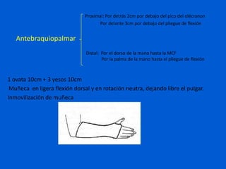 Proximal: Por detrás 2cm por debajo del pico del olécranon
                                     Por delante 3cm por debajo del pliegue de flexión


   Antebraquiopalmar
                               Distal: Por el dorso de la mano hasta la MCF
                                       Por la palma de la mano hasta el pliegue de flexión



1 ovata 10cm + 3 yesos 10cm
 Muñeca en ligera flexión dorsal y en rotación neutra, dejando libre el pulgar.
Inmovilización de muñeca
 