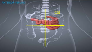 CSI
ANTERIOR-YEYUNO
 
