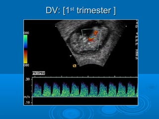 DV: [1st trimester ]
 