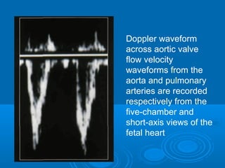 Doppler waveform
across aortic valve
flow velocity
waveforms from the
aorta and pulmonary
arteries are recorded
respectively from the
five-chamber and
short-axis views of the
fetal heart
 