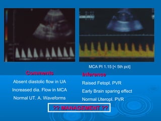 MCA PI 1.15 [< 5th pct]
Comments
Absent diastolic flow in UA
Increased dia. Flow in MCA
Normal UT. A. Waveforms
Inference
Raised Fetopl. PVR
Early Brain sparing effect
Normal Uteropl. PVR
?? MANAGEMENT ??
 