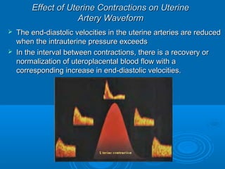 Effect of Uterine Contractions on Uterine
Artery Waveform
 The end-diastolic velocities in the uterine arteries are reduced
when the intrauterine pressure exceeds
 In the interval between contractions, there is a recovery or
normalization of uteroplacental blood flow with a
corresponding increase in end-diastolic velocities.
 