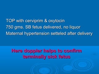 TOP with cerviprim & oxytocin
750 gms. SB fetus delivered, no liquor
Maternal hypertension setteled after delivery
Here doppler helps to confirm
terminally sick fetus
 