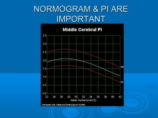 NORMOGRAM & PI ARE
IMPORTANT
 