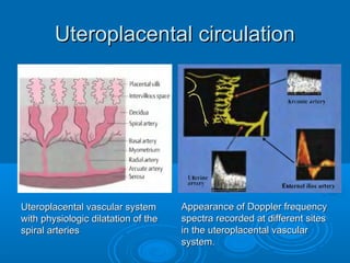 Uteroplacental circulation
Uteroplacental vascular system
with physiologic dilatation of the
spiral arteries
Appearance of Doppler frequency
spectra recorded at different sites
in the uteroplacental vascular
system.
 