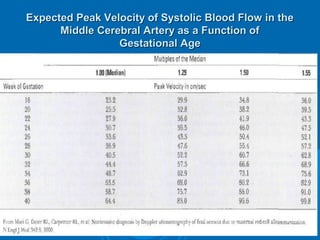 Expected Peak Velocity of Systolic Blood Flow in the
Middle Cerebral Artery as a Function of
Gestational Age
 