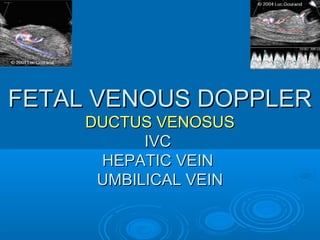 FETAL VENOUS DOPPLER
DUCTUS VENOSUS
IVC
HEPATIC VEIN
UMBILICAL VEIN
 