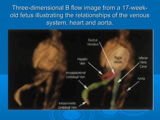 Three-dimensional B flow image from a 17-week-
old fetus illustrating the relationships of the venous
system, heart and aorta.
 