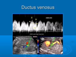 Ductus venosus
 