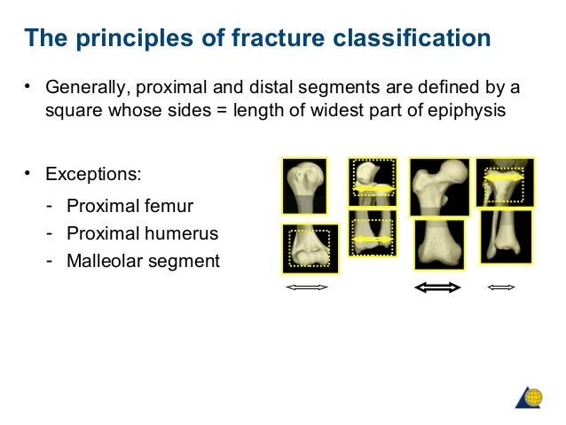 Ao Classification