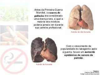 Tabagismo
Disciplina: Ciências Naturais
Colégio Conciliar de Maria Imaculada
Com o crescimento da
popularidade do tabagismo após
a guerra, houve um aumento
epidémico de cancro de
pulmão.
Antes da Primeira Guerra
Mundial, o cancro de
pulmão era considerado
uma doença rara, a qual a
maioria dos médicos
poderia jamais ver durante
sua carreira profissional.
 