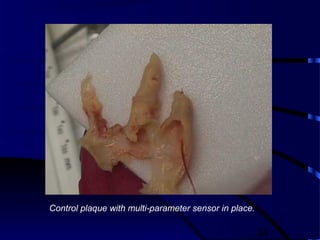 34
Control plaque with multi-parameter sensor in place.
 