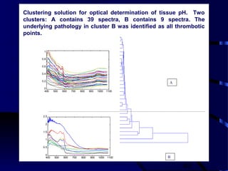 49
400 500 600 700 800 900 1000 1100
0
0.5
1
1.5
2
2.5
400 500 600 700 800 900 1000 1100
0
0.2
0.4
0.6
0.8
1
A
B
Clustering solution for optical determination of tissue pH. Two
clusters: A contains 39 spectra, B contains 9 spectra. The
underlying pathology in cluster B was identified as all thrombotic
points.
 