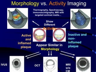 6
Morphology vs. Activity Imaging
Inactive and
non-
inflamed
plaque
Active
and
inflamed
plaque
Appear Similar in
IVUS OCT MRI
w/o
CM
Morphology
Show
Different
Activity
Thermography, Spectroscopy,
immunoscintigraphy, MRI with
targeted contrast media…
 