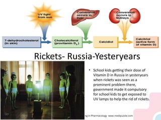 Rickets- Russia-Yesteryears
• School kids getting their dose of
Vitamin D in Russia in yesteryears
when rickets was seen as a
prominent problem there,
government made it compulsory
for school kids to get exposed to
UV lamps to help the rid of rickets.
 