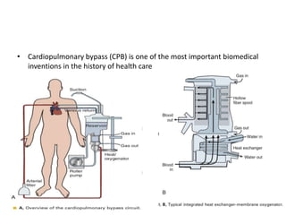CPB(CARDIO PULMONARY BYPASS) | PPTX