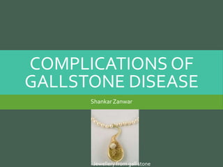 COMPLICATIONS OF
GALLSTONE DISEASE
ShankarZanwar
Jewellery from gall stone
 