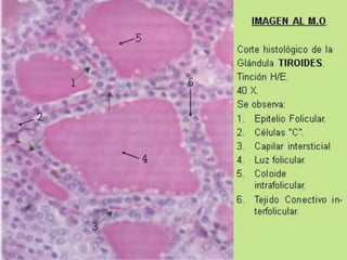 9/19/2020 3
IMAGEN AL M.O.
Corte histológico de la
Glándula TIROIDES.
Tinción H/E.
40 X.
Se observa:
1. Epitelio Folicular.
2. Células “C”.
3. Capilar intersticial
4. Luz folicular.
5. Coloide
intrafolicular.
6. Tejido Conectivo in-
terfolicular.
 
