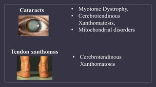 • Myotonic Dystrophy,
• Cerebrotendinous
Xanthomatosis,
• Mitochondrial disorders
Cataracts
• Cerebrotendinous
Xanthomatosis
Tendon xanthomas
 