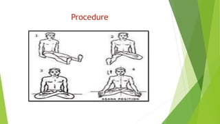 Procedure
 