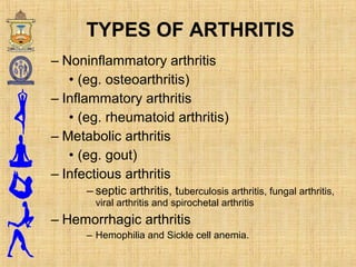 – Noninflammatory arthritis
• (eg. osteoarthritis)
– Inflammatory arthritis
• (eg. rheumatoid arthritis)
– Metabolic arthritis
• (eg. gout)
– Infectious arthritis
– septic arthritis, tuberculosis arthritis, fungal arthritis,
viral arthritis and spirochetal arthritis
– Hemorrhagic arthritis
– Hemophilia and Sickle cell anemia.
TYPES OF ARTHRITIS
 
