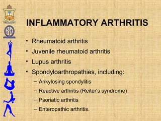 INFLAMMATORY ARTHRITIS
• Rheumatoid arthritis
• Juvenile rheumatoid arthritis
• Lupus arthritis
• Spondyloarthropathies, including:
– Ankylosing spondylitis
– Reactive arthritis (Reiter's syndrome)
– Psoriatic arthritis
– Enteropathic arthritis.
 