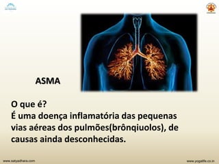 www.yogalife.co.inwww.satyadhara.com
ASMA
O que é?
É uma doença inflamatória das pequenas
vias aéreas dos pulmões(brônqiuolos), de
causas ainda desconhecidas.
 