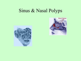 Sinus & Nasal Polyps 