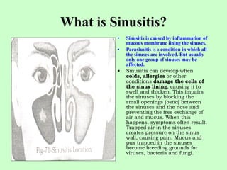 What is Sinusitis? Sinusitis is caused by inflammation of mucous membrane lining the sinuses.   Parasiusitis  is a  condition in which all the sinuses are involved. But usually only one group of sinuses may be affected. Sinusitis can develop when  colds, allergies  or other conditions  damage the cells of the sinus lining , causing it to swell and thicken. This impairs the sinuses by blocking the small openings ( ostia ) between the sinuses and the nose and preventing the free exchange of air and mucus. When this happens, symptoms often result. Trapped air in the sinuses creates pressure on the sinus wall, causing pain. Mucus and pus trapped in the sinuses become breeding grounds for viruses, bacteria and fungi. 