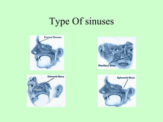 Type Of sinuses 
