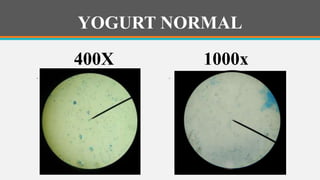 ESTUDIO PRACTICO CON LAS BACTERIAS DEL YOGURT. Observación de células ...