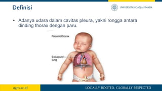 Definisi
• Adanya udara dalam cavitas pleura, yakni rongga antara
dinding thorax dengan paru.
 