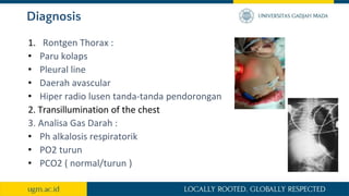Diagnosis
1. Rontgen Thorax :
• Paru kolaps
• Pleural line
• Daerah avascular
• Hiper radio lusen tanda-tanda pendorongan
2. Transillumination of the chest
3. Analisa Gas Darah :
• Ph alkalosis respiratorik
• PO2 turun
• PCO2 ( normal/turun )
 