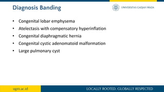 Diagnosis Banding
• Congenital lobar emphysema
• Atelectasis with compensatory hyperinflation
• Congenital diaphragmatic hernia
• Congenital cystic adenomatoid malformation
• Large pulmonary cyst
 