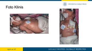 Foto Klinis
 