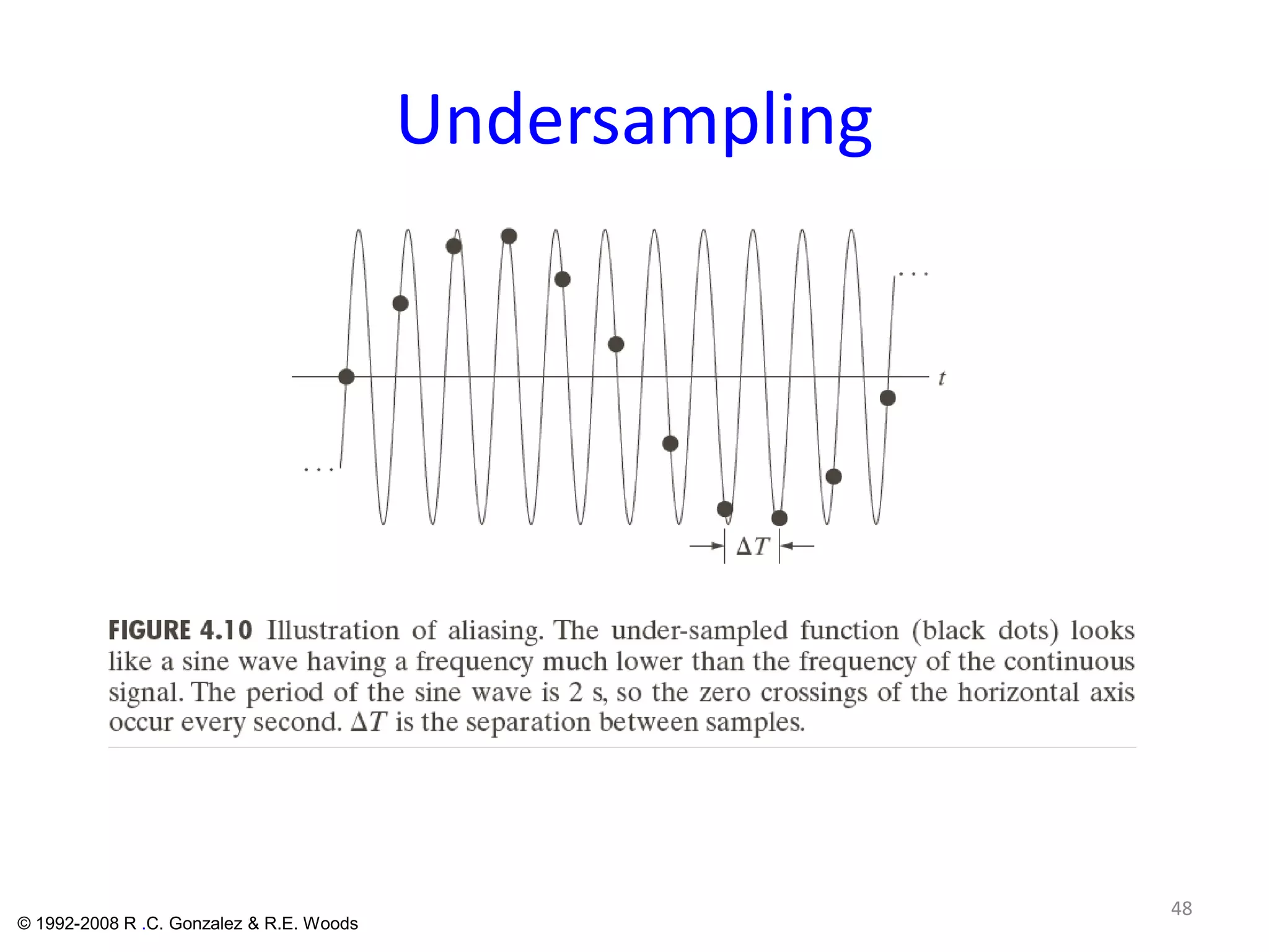 Undersampling
48
© 1992-2008 R .C. Gonzalez & R.E. Woods
 