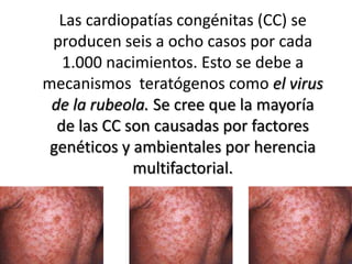 Las cardiopatías congénitas (CC) se
 producen seis a ocho casos por cada
   1.000 nacimientos. Esto se debe a
mecanismos teratógenos como el virus
 de la rubeola. Se cree que la mayoría
  de las CC son causadas por factores
 genéticos y ambientales por herencia
             multifactorial.
 