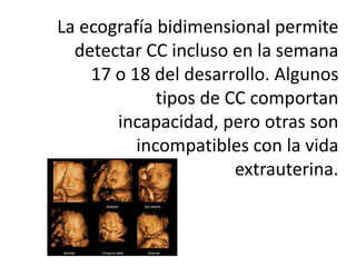 La ecografía bidimensional permite
  detectar CC incluso en la semana
    17 o 18 del desarrollo. Algunos
             tipos de CC comportan
       incapacidad, pero otras son
          incompatibles con la vida
                       extrauterina.
 