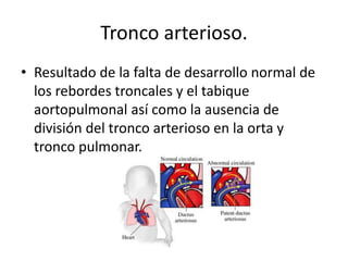 Tronco arterioso.
• Resultado de la falta de desarrollo normal de
  los rebordes troncales y el tabique
  aortopulmonal así como la ausencia de
  división del tronco arterioso en la orta y
  tronco pulmonar.
 