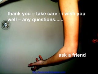 thank you – take care - i wish you
well – any questions......
ask a friend
http://lesbicknell.blogspot.com/
 
