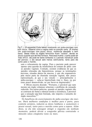 Fig.7 — (À esquerda) Corte lateral mostrando um pubo-coccígeo com
bom tônus. Observe como a vagina está na posição certa. (A direita)
Um pubo-coccígeo com pouco tônus, mostra-se abaulado e bem
baixo. Desse modo os órgãos femininos ficam "caídos", devido ao
pouco suporte que ele lhes fornece. Para essa mulher, o parto pode ser
mais difícil; ela pode ter dores lombares e o período menstrual pode
ser penoso; o ato sexual será menos estimulante, tanto para ela
como para o marido.
com o relaxamento da vagina. Para a paciente pode parecer
apenas uma questão de insuficiência de contato do pênis com
as paredes vaginais. Contudo, existem evidências de que as
paredes relaxadas são hipoestésicas, porque as terminações
nervosas, situadas abaixo da mucosa, e que são responsáveis
pela maior parte da chamada sensação vaginal, têm pouca
representação, já que o seu veículo — principalmente o
pubo-coccígeo — acha-se hipotrofiado (isto é, fraco, ou por
estar pouco desenvolvido, ou por haver-se degenerado)."
E Oliven encerra dizendo: "Portanto, é provável que nem
mesmo um órgão volumoso solucione o problema da sensação
reduzida. Em outras palavras, quando as paredes vaginais não
se contraem de forma a oferecer tensão e resistência, é provável
que a sensação seja bem limitada, não importa o tamanho do
órgão masculino." 2
Os benefícios do exercitamento do pubo-coccígeo são mui-
tos. Dará melhores condições à mulher para o parto, para
controle urinário, reduzirá as dores lombares e aumentará o
prazer sexual, tanto para o marido como para a esposa. Além
disso, se ela não conseguir atingir o orgasmo em nenhum
momento, poderá aliviar a congestão pélvica contraindo o
músculo umas cinqüenta vezes ou mais.
138
 