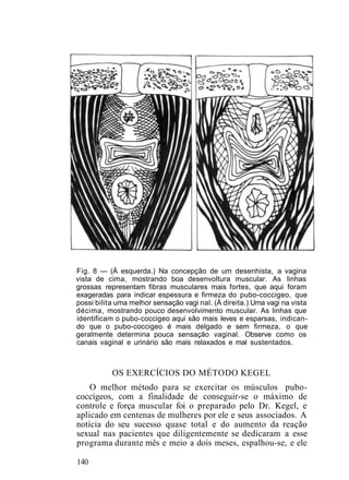 Fig. 8 — (À esquerda.) Na concepção de um desenhista, a vagina
vista de cima, mostrando boa desenvoltura muscular. As linhas
grossas representam fibras musculares mais fortes, que aqui foram
exageradas para indicar espessura e firmeza do pubo-coccigeo, que
possi bilita uma melhor sensação vagi nal. (À direita.) Uma vagi na vista
décima, mostrando pouco desenvolvimento muscular. As linhas que
identificam o pubo-coccigeo aqui são mais leves e esparsas, indican-
do que o pubo-coccigeo é mais delgado e sem firmeza, o que
geralmente determina pouca sensação vaginal. Observe como os
canais vaginal e urinário são mais relaxados e mal sustentados.
OS EXERCÍCIOS DO MÉTODO KEGEL
O melhor método para se exercitar os músculos pubo-
coccígeos, com a finalidade de conseguir-se o máximo de
controle e força muscular foi o preparado pelo Dr. Kegel, e
aplicado em centenas de mulheres por ele e seus associados. A
notícia do seu sucesso quase total e do aumento da reação
sexual nas pacientes que diligentemente se dedicaram a esse
programa durante mês e meio a dois meses, espalhou-se, e ele
140
 