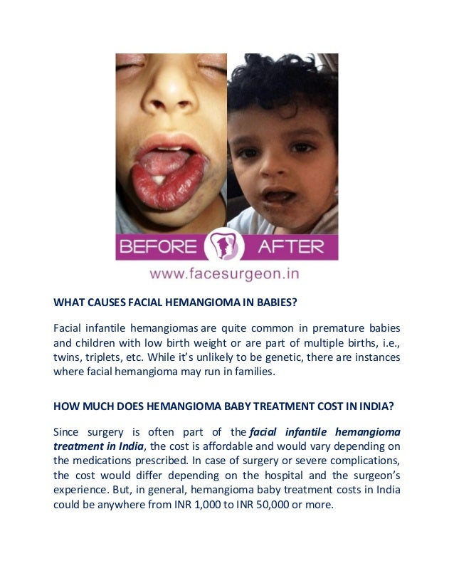 WHAT CAUSES FACIAL HEMANGIOMA IN BABIES?
Facial infantile hemangiomas are quite common in premature babies
and children with low birth weight or are part of multiple births, i.e.,
twins, triplets, etc. While it’s unlikely to be genetic, there are instances
where facial hemangioma may run in families.
HOW MUCH DOES HEMANGIOMA BABY TREATMENT COST IN INDIA?
Since surgery is often part of the facial infantile hemangioma
treatment in India, the cost is affordable and would vary depending on
the medications prescribed. In case of surgery or severe complications,
the cost would differ depending on the hospital and the surgeon’s
experience. But, in general, hemangioma baby treatment costs in India
could be anywhere from INR 1,000 to INR 50,000 or more.
 