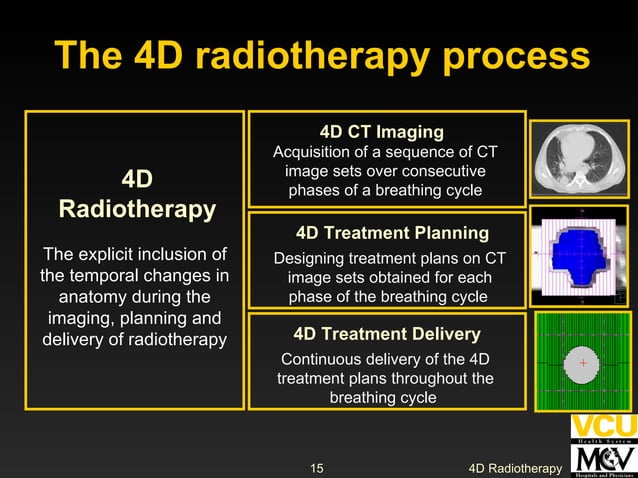 4D Radiotherapy | PPT