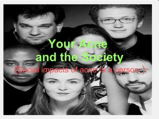 Your Acne  and the Society ( Social impacts of acne to a person  ) 