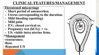 Meet Marcos.
He recently opened a camera shop
near the Louvre in Paris.
Visitors to his store, mostly tourists,
speak many different languages
making anything beyond a simple
transaction a challenge.
Tip
If one example isn’t
sufficient to help people
understand the breadth
of your idea, pick a
couple of examples.
Story for illustration purposes only
 