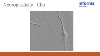 Neuroplasticity - Clip
14
 