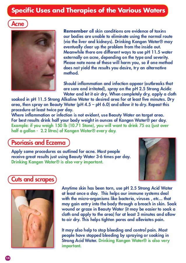 kangen water and eczema